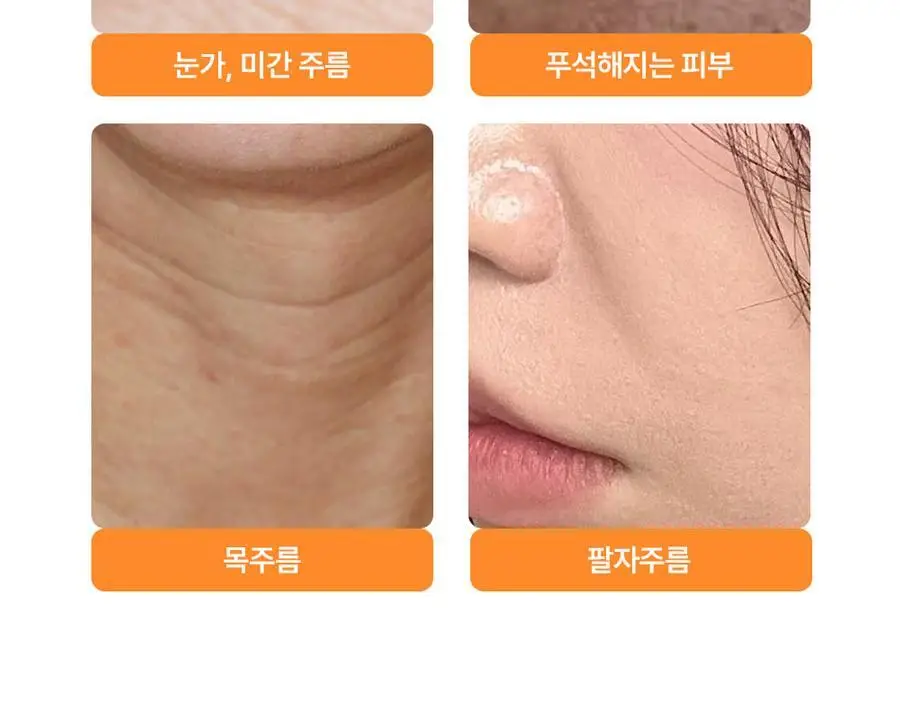 [탄력주름] 프랭클리 PDRN 바운스볼 광채세럼 30ml 앰플 상세페이지 5